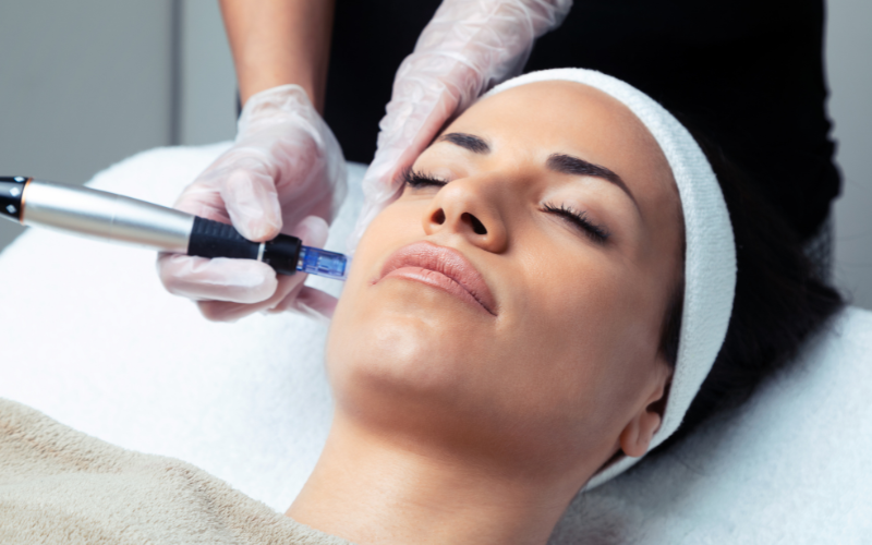 Microneedling Oregon City, OR Woman receiving a microneedling procedure