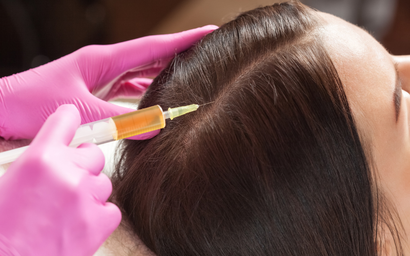 Woman receiving hair restoration